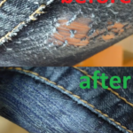 blue jeans thigh chafing reconstruction